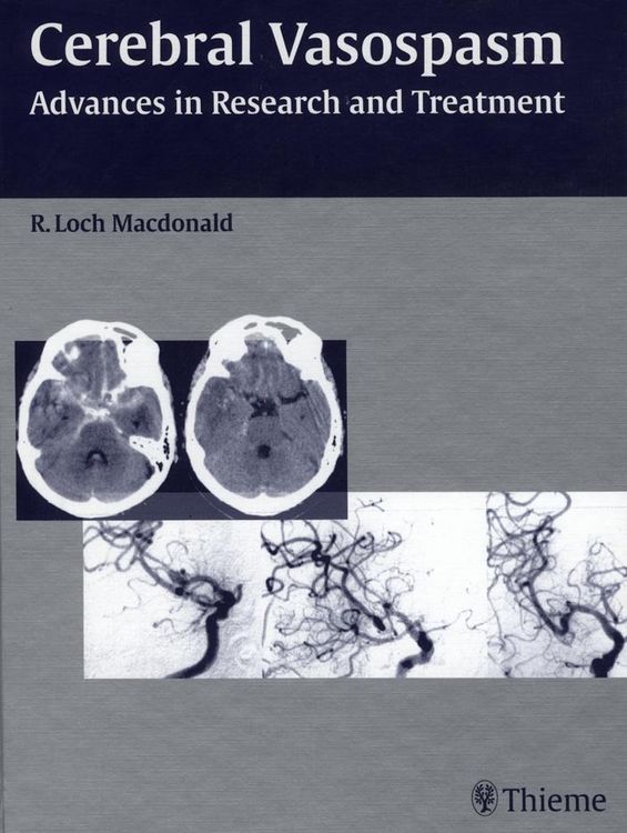 Produktbild: Cerebral Vasospasm