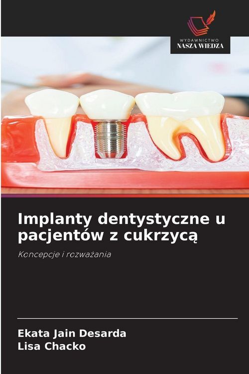 Produktbild: Implanty dentystyczne u pacjent&oacute;w z cukrzyc&iquest;