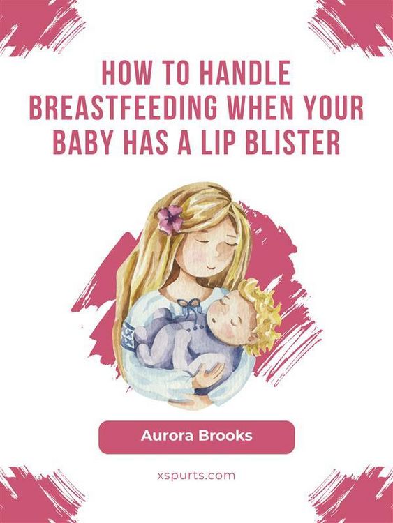 Produktbild: How to handle breastfeeding when your baby has a lip blister