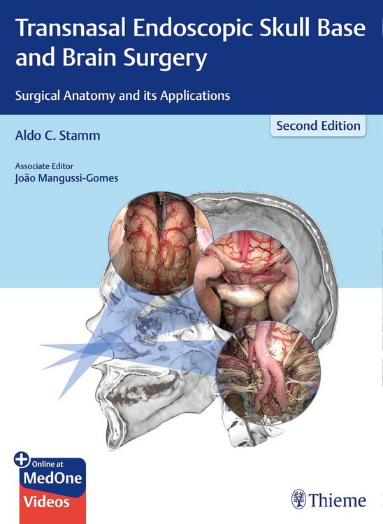 Produktbild: Transnasal Endoscopic Skull Base and Brain Surgery