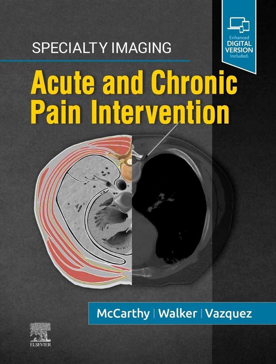 Produktbild: Specialty Imaging: Acute and Chronic Pain Intervention