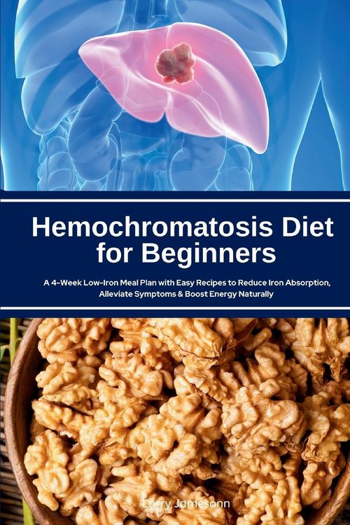 Produktbild: Hemochromatosis Diet for Beginners