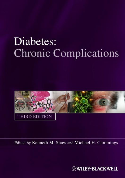 Produktbild: Diabetes Chronic Complications