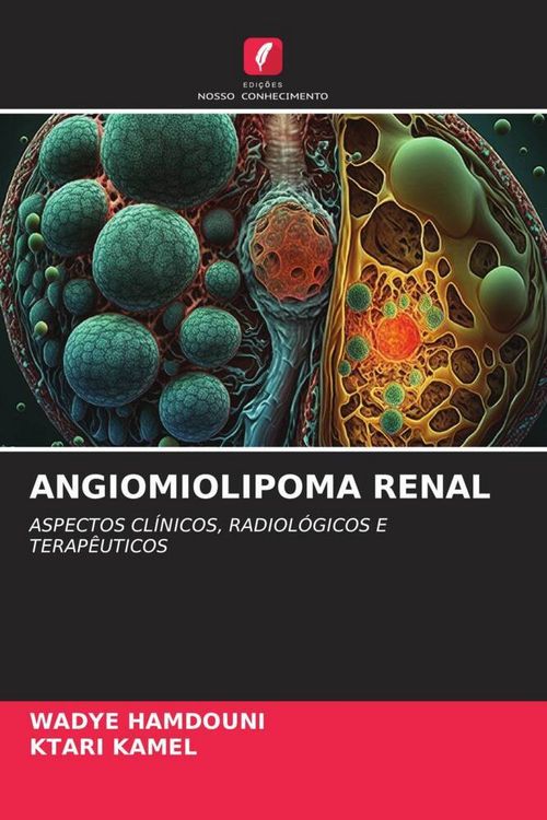 Produktbild: Angiomiolipoma Renal