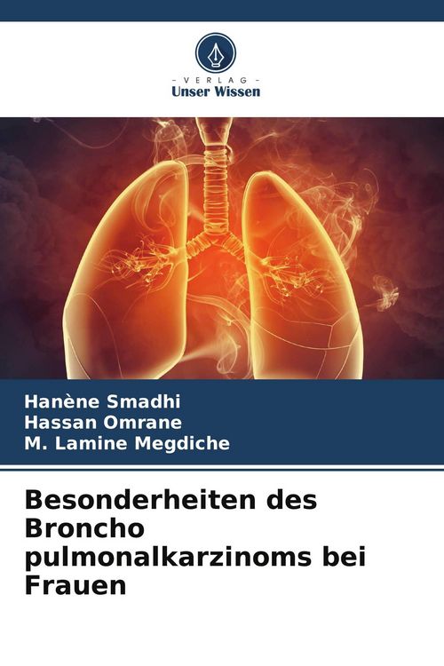 Produktbild: Besonderheiten des Broncho pulmonalkarzinoms bei Frauen