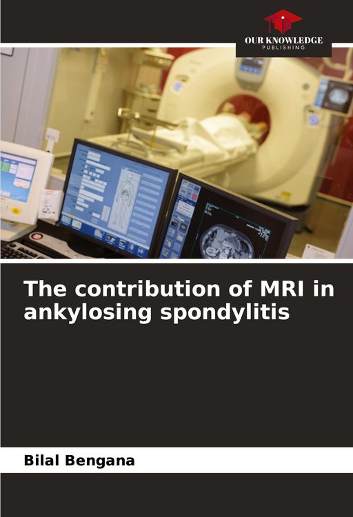 Produktbild: The contribution of MRI in ankylosing spondylitis