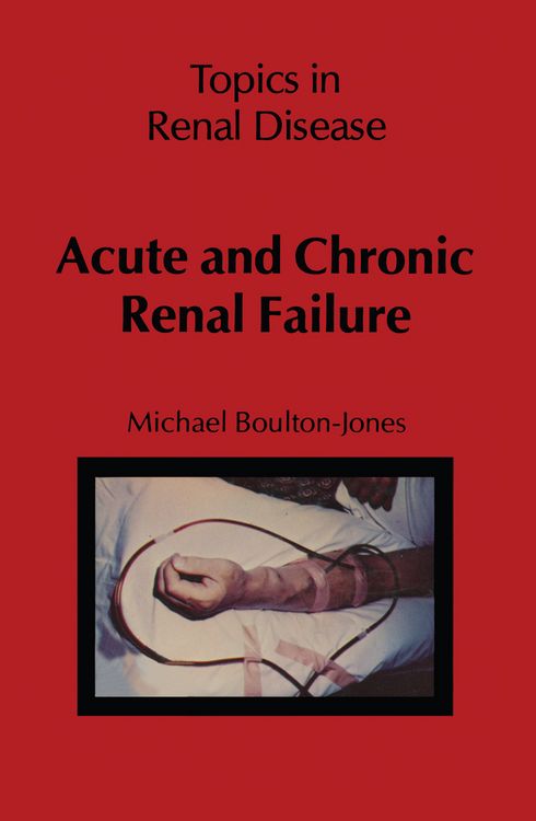 Produktbild: Acute and Chronic Renal Failure
