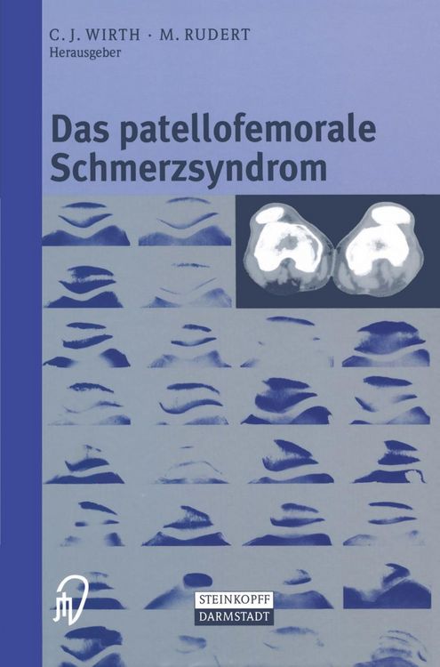 Produktbild: Das patellofemorale Schmerzsyndrom