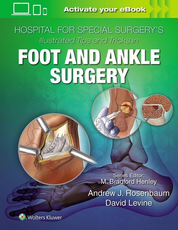 Produktbild: Hospital for Special Surgery's Illustrated Tips and Tricks in Foot and Ankle Surgery