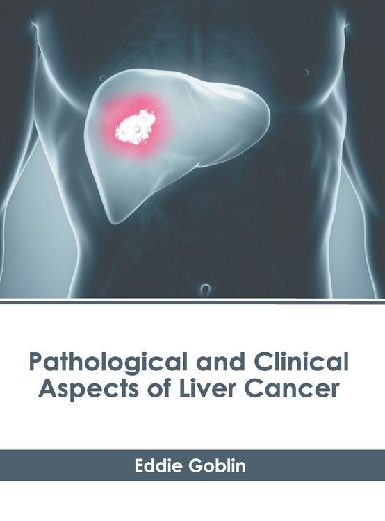 Produktbild: Pathological and Clinical Aspects of Liver Cancer