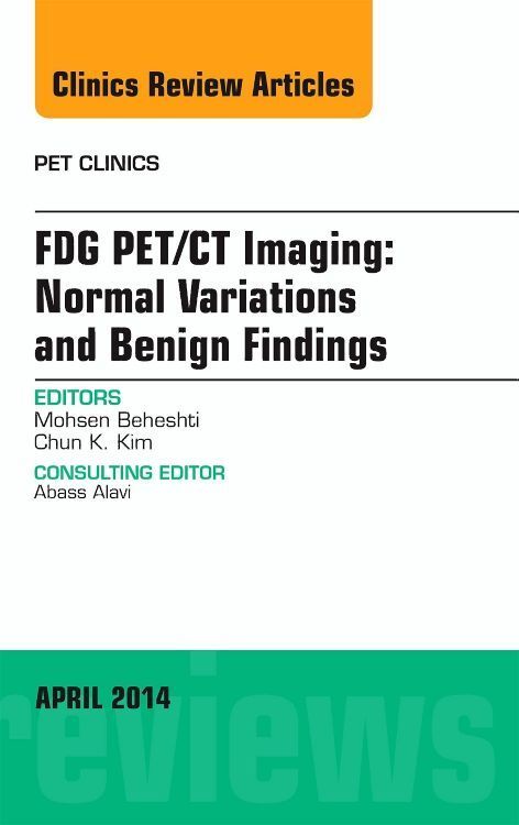 Produktbild: Fdg Pet/CT Imaging: Normal Variations and Benign Findings - Translation to Pet/Mri, an Issue of Pet Clinics