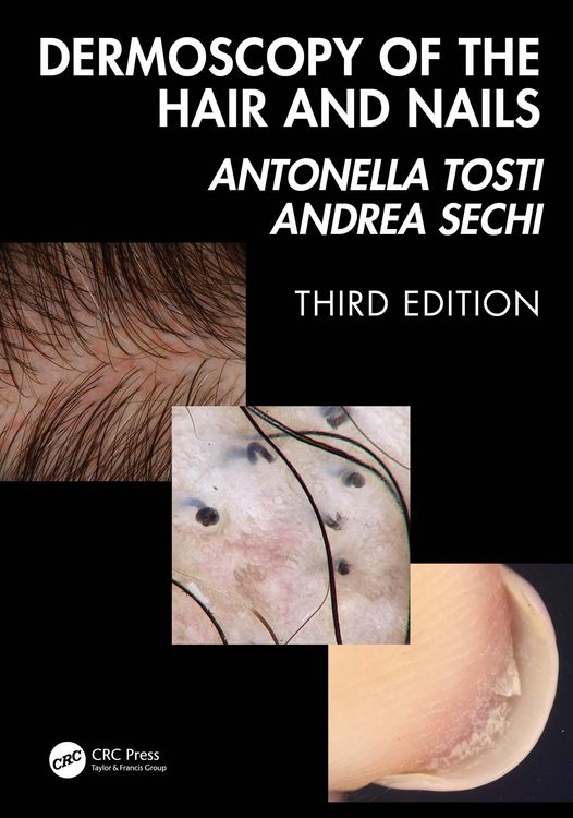 Produktbild: Dermoscopy of the Hair and Nails 3e