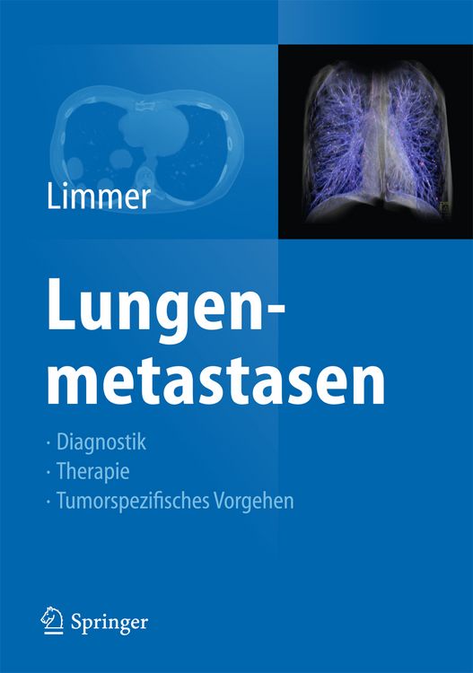 Produktbild: Lungenmetastasen