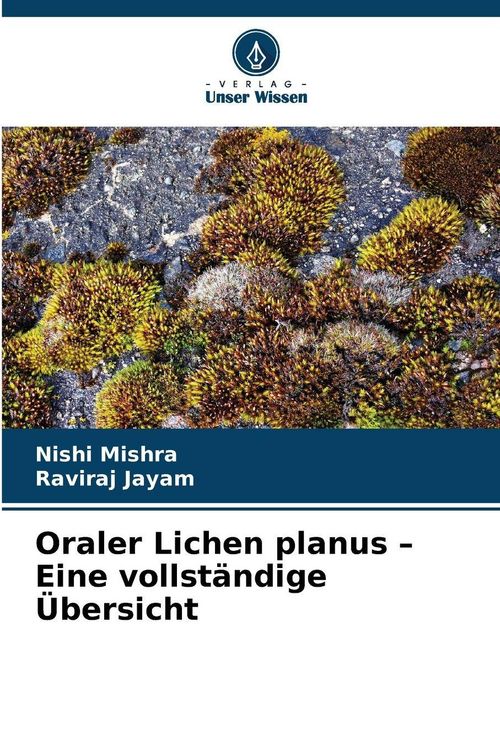 Produktbild: Oraler Lichen planus - Eine vollst&auml;ndige &Uuml;bersicht