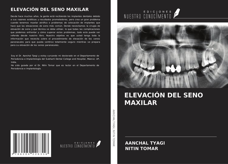 Produktbild: Elevaci&oacute;n Del Seno Maxilar