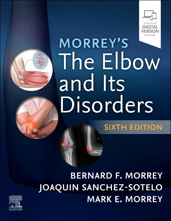 Produktbild: Morrey's the Elbow and Its Disorders