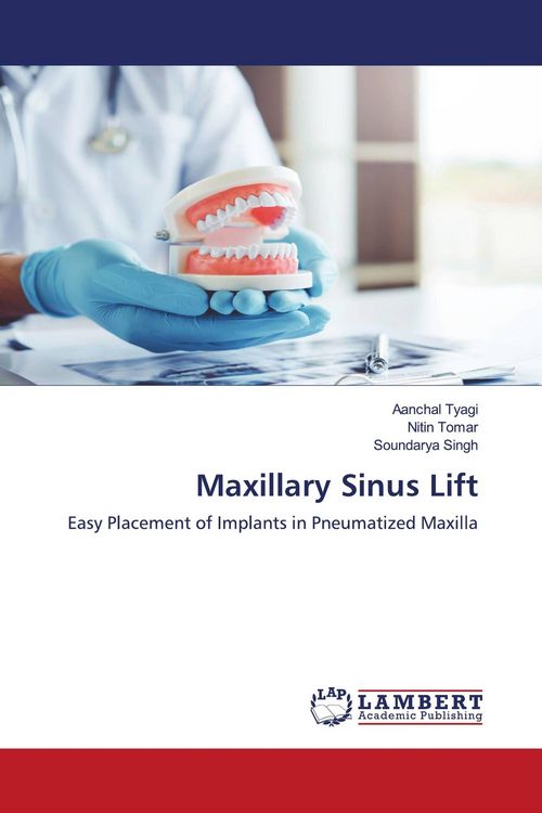 Produktbild: Maxillary Sinus Lift