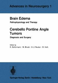 Produktbild: Brain Edema / Cerebello Pontine Angle Tumors