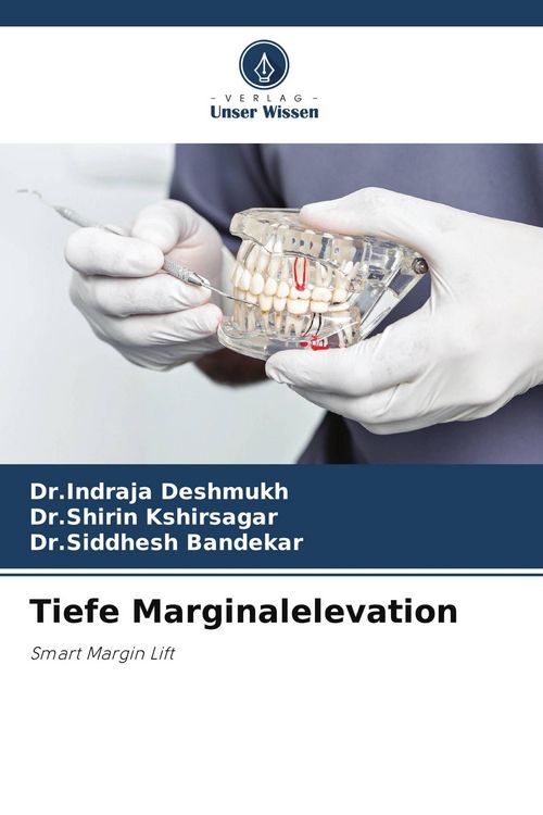 Produktbild: Tiefe Marginalelevation
