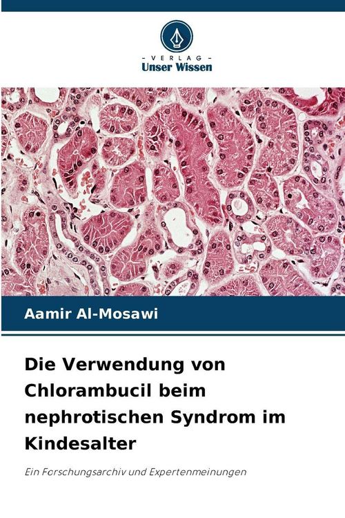 Produktbild: Die Verwendung von Chlorambucil beim nephrotischen Syndrom im Kindesalter