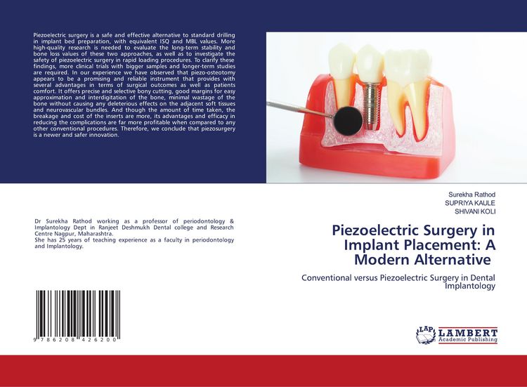 Produktbild: Piezoelectric Surgery in Implant Placement: A Modern Alternative