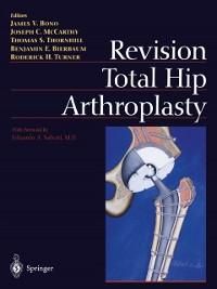 Produktbild: Revision Total Hip Arthroplasty