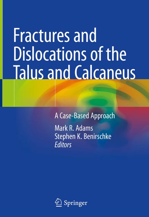 Produktbild: Fractures and Dislocations of the Talus and Calcaneus