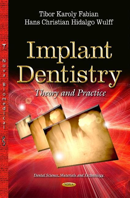 Produktbild: Fabian, T: Implant Dentistry