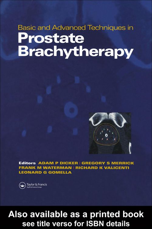 Produktbild: Basic and Advanced Techniques in Prostate Brachytherapy