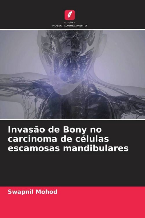 Produktbild: Invas&atilde;o de Bony no carcinoma de c&eacute;lulas escamosas mandibulares