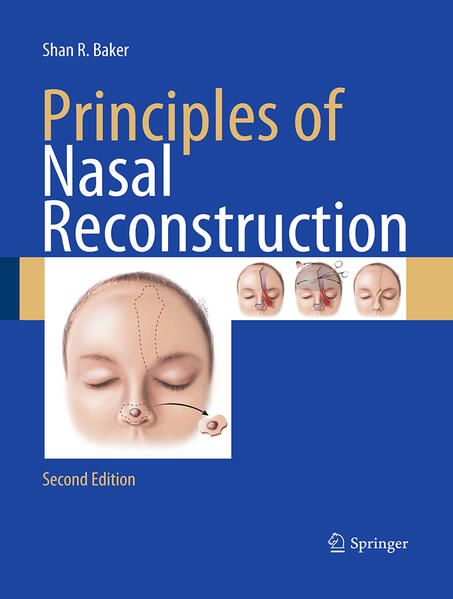 Produktbild: Principles of Nasal Reconstruction