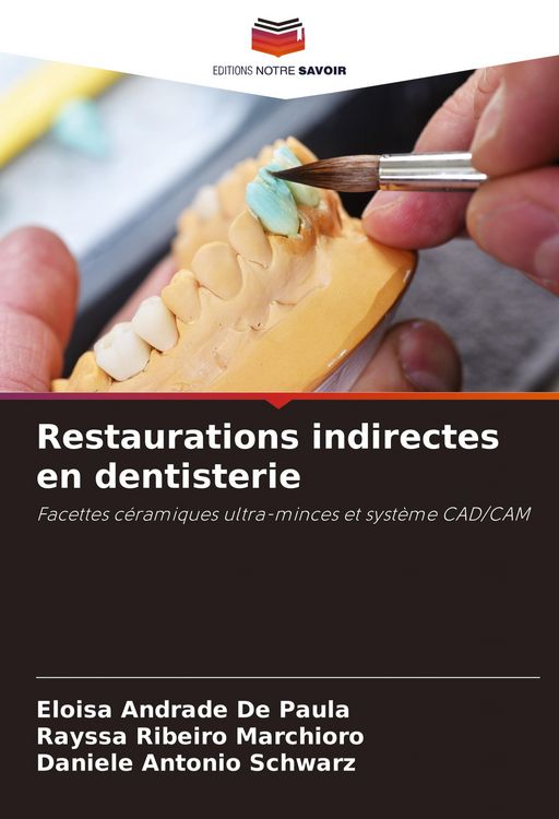 Produktbild: Restaurations indirectes en dentisterie