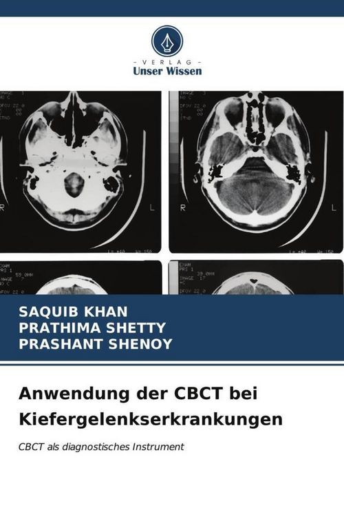 Produktbild: Anwendung der CBCT bei Kiefergelenkserkrankungen