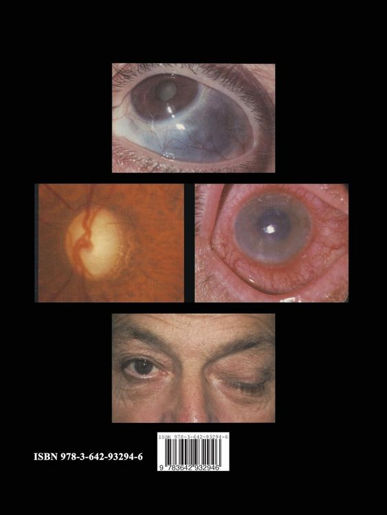 Produktbild: Auge und Allgemeinerkrankungen