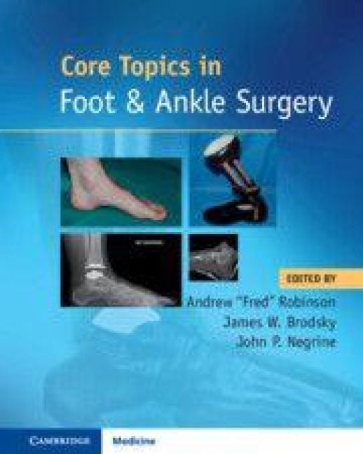 Produktbild: Core Topics in Foot and Ankle Surgery