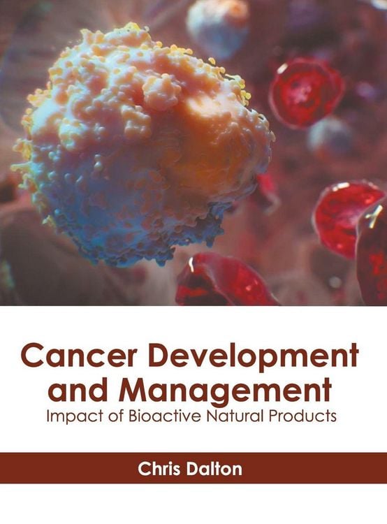 Produktbild: Cancer Development and Management: Impact of Bioactive Natural Products