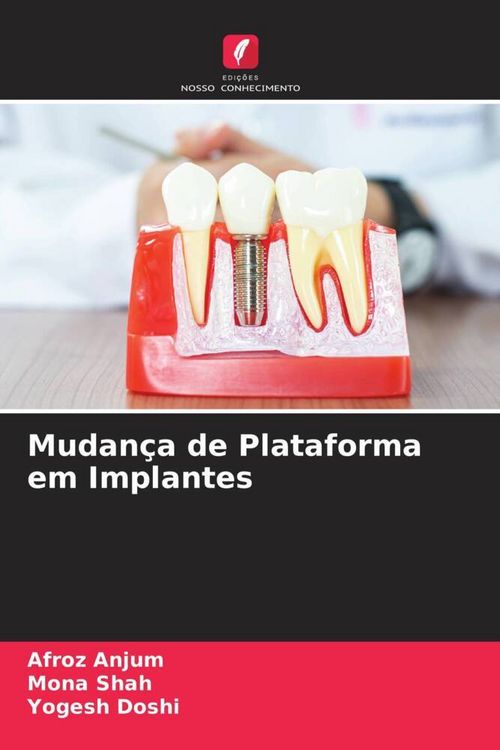 Produktbild: Mudan&ccedil;a de Plataforma em Implantes