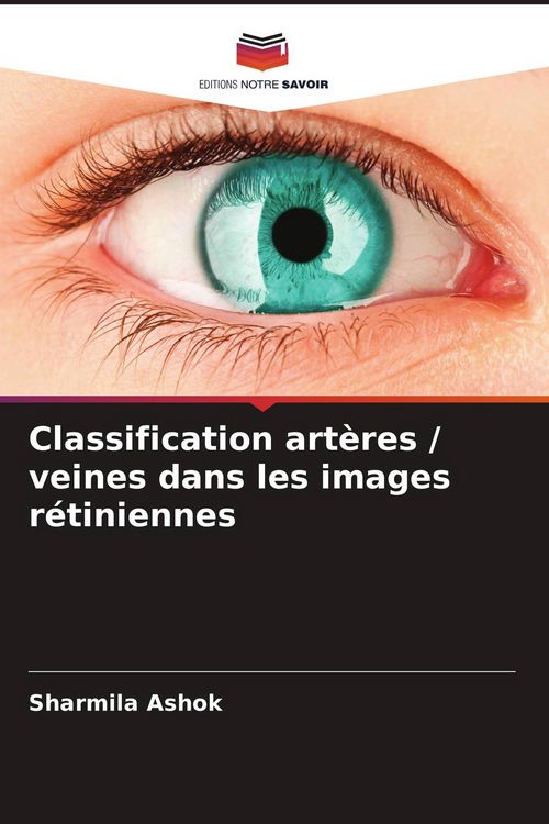 Produktbild: Classification art&egrave;res / veines dans les images r&eacute;tiniennes