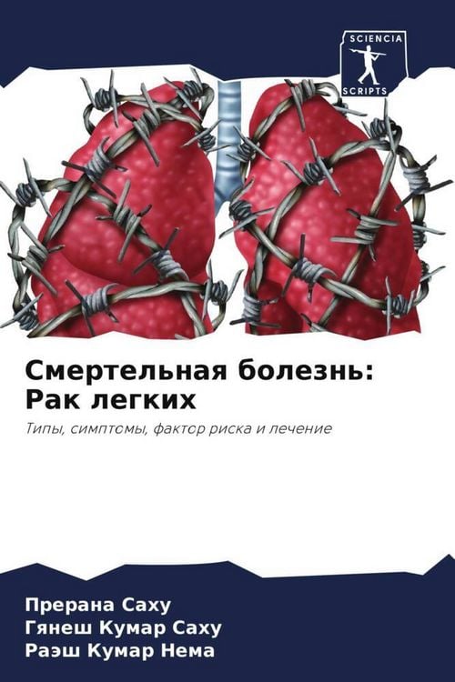 Produktbild: Smertel'naq bolezn': Rak legkih