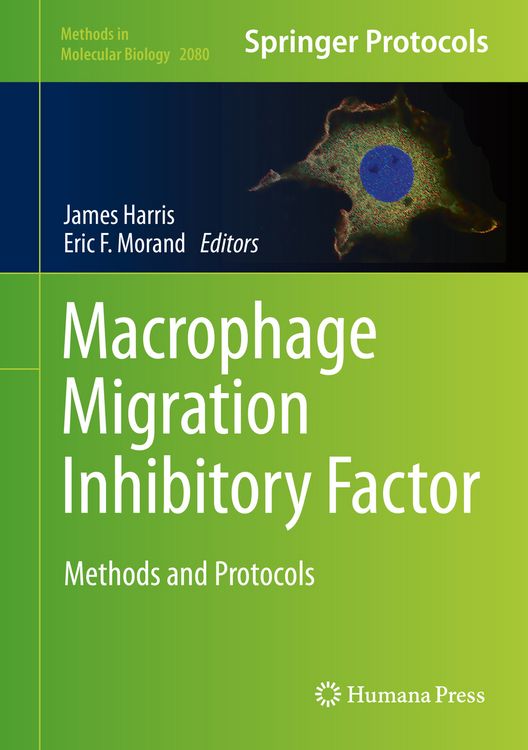 Produktbild: Macrophage Migration Inhibitory Factor