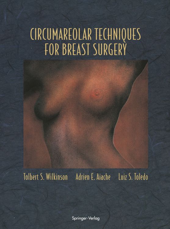 Produktbild: Circumareolar Techniques for Breast Surgery