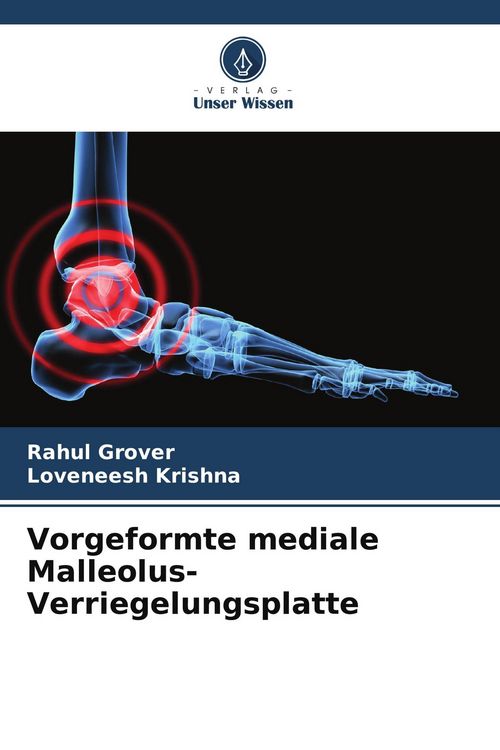 Produktbild: Vorgeformte mediale Malleolus-Verriegelungsplatte