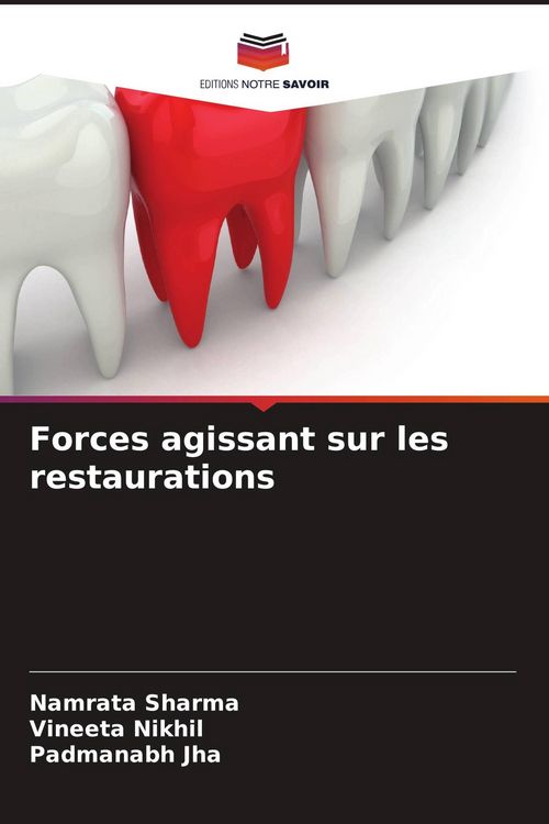 Produktbild: Forces agissant sur les restaurations