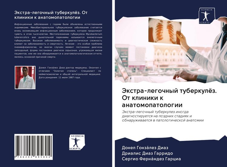 Produktbild: Jextra-legochnyj tuberkul&ouml;z. Ot kliniki k anatomopatologii