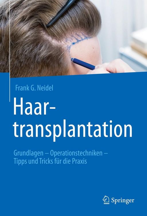 Produktbild: Haartransplantation