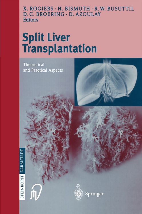 Produktbild: Split liver transplantation