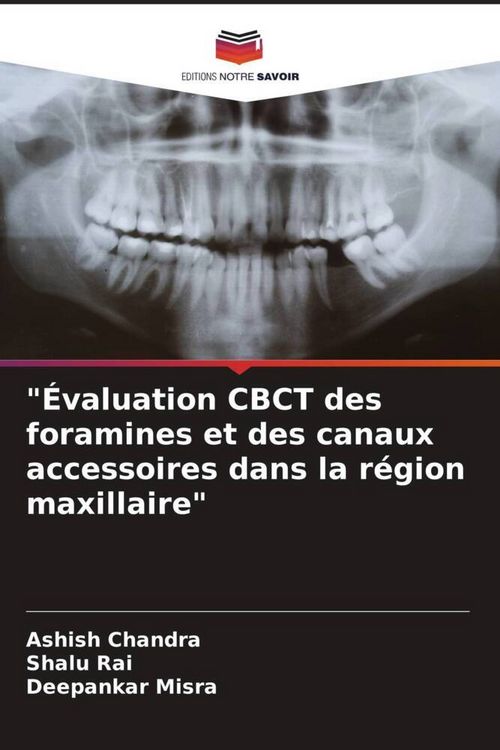 Produktbild: "&Eacute;valuation CBCT des foramines et des canaux accessoires dans la r&eacute;gion maxillaire"