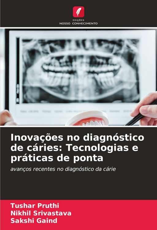 Produktbild: Inova&ccedil;&otilde;es no diagn&oacute;stico de c&aacute;ries: Tecnologias e pr&aacute;ticas de ponta