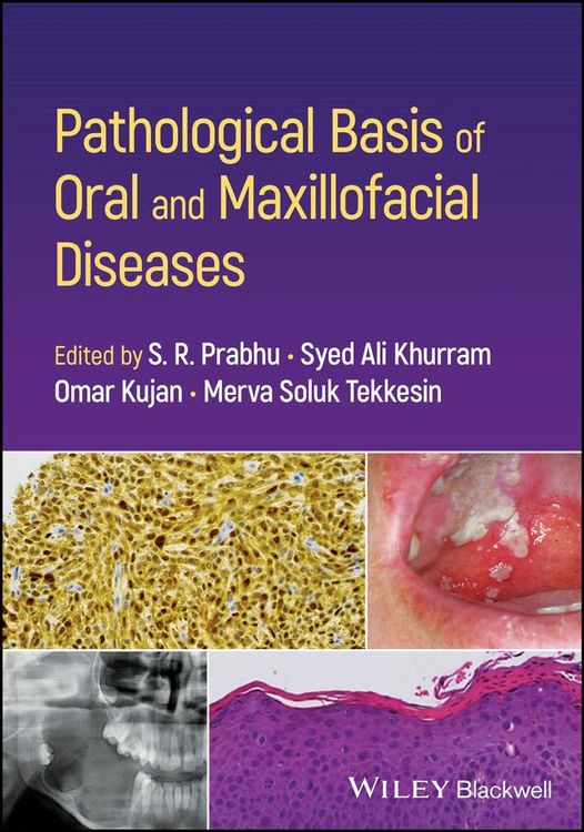 Produktbild: Pathological Basis of Oral and Maxillofacial Diseases