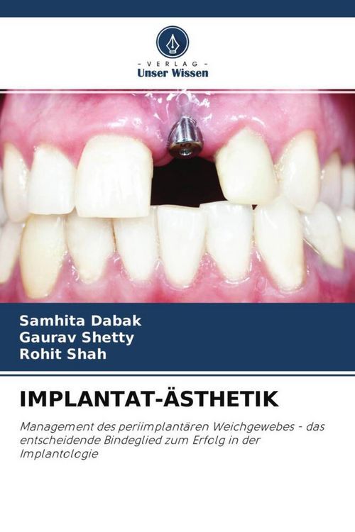 Produktbild: Implantat-&Auml;sthetik